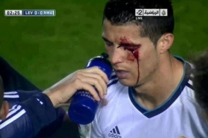 莱万特旧将:我过去曾无意肘击C罗,媒体却几乎要把我关进监狱 配图