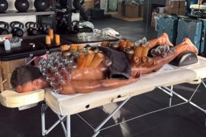 东方神秘力量!尤文前锋奥蓬达拔罐治疗,从脖子到小腿全是罐子 配图