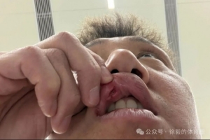 高迪赛后共缝九针：昨天蛮疼今天又是一条好汉，不想错过踢申花 配图