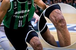 贾巴里·帕克膝盖近照：沟壑纵横 千疮百孔！曾遭两次ACL撕裂 配图