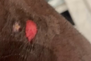 詹姆斯自拍展示右腿上的伤口：可能是年度最佳扑球造成的！好痛！ 配图