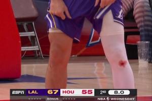 东契奇&库里膝盖出血之谜：不是药水 而是地板擦伤留下的真实血迹 配图