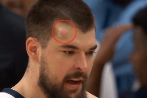 “头上有犄角！”祖巴茨防守时被克林根打出包 回更衣室&回归成疑 配图