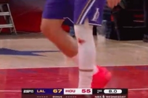 抹药了！东契奇左膝带伤作战 白色护膝已见红 配图