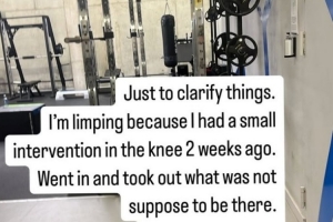 库卢社媒发文:一瘸一拐是因为膝盖进行了一次小手术,现在很好 配图